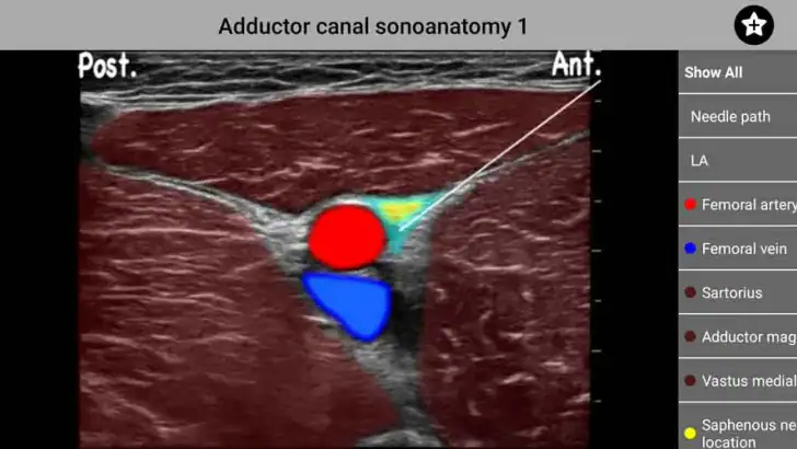AnSo Anaesthesia Sonoanatomy feature graphic