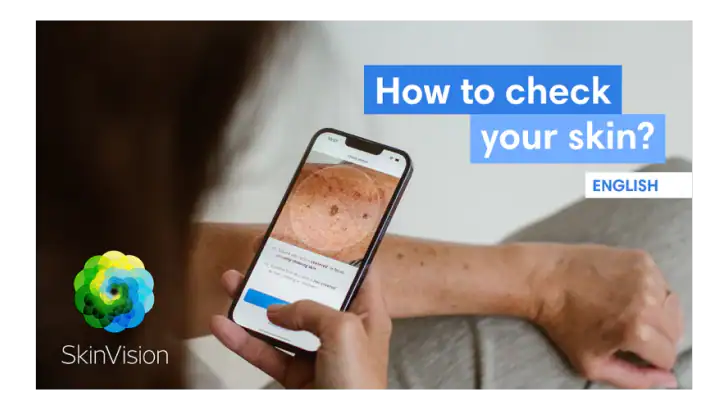 SkinVision - Find Skin Cancer feature graphic