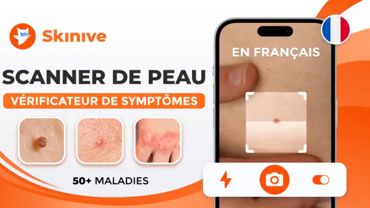 Scanner santé peau: Skinive AI feature graphic