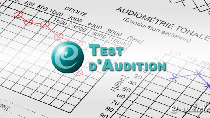 Test d'Audition feature graphic