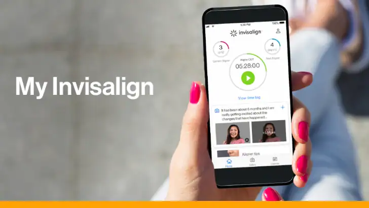 My Invisalign feature graphic
