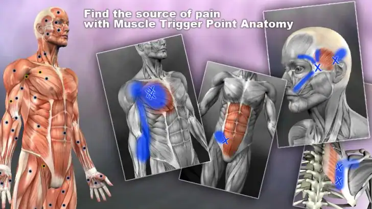 Muscle Trigger Point Anatomy feature graphic