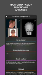 RX - Posiciones Radiológicas screenshot