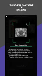 RX - Posiciones Radiológicas screenshot