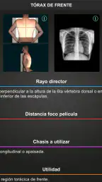 RX - Posiciones Radiológicas screenshot
