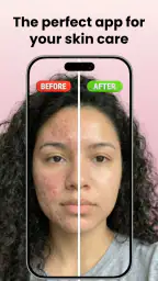 Skin Care Scanner: GlowUp screenshot