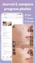 Skincare Routine: FeelinMySkin screenshot