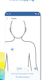 SkinVision - Find Skin Cancer screenshot