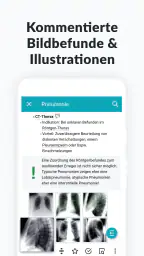 AMBOSS Wissen für Mediziner screenshot