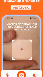 Haut Scanner: KI hautarzt app screenshot