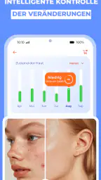 Haut Scanner: KI hautarzt app screenshot