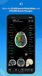 IMAIOS e-Anatomy screenshot