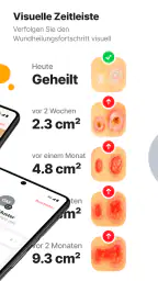 imitoWound - Wunddokumentation screenshot