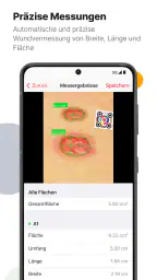 imitoWound - Wunddokumentation screenshot