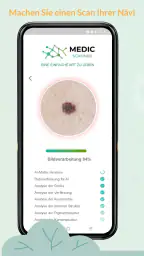 Medic Scanner - Hautanalyse screenshot