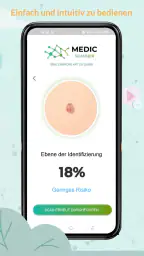 Medic Scanner - Hautanalyse screenshot