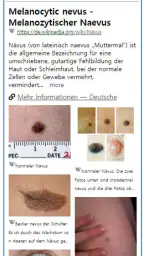 Model Dermatol – Hautkrankheit screenshot