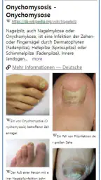 Model Dermatol – Hautkrankheit screenshot