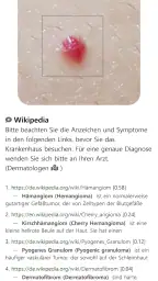 Model Dermatol – Hautkrankheit screenshot