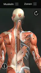 Muskel Triggerpunkte Anatomie screenshot