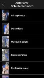 Muskel Triggerpunkte Anatomie screenshot