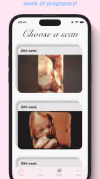 ScanBaby learn baby ultrasound screenshot