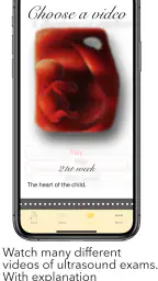 ScanBaby learn baby ultrasound screenshot