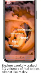 ScanBaby learn baby ultrasound screenshot