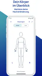 SkinScreener screenshot