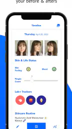 SkinTheory Skin + Acne Tracker screenshot