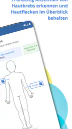 SkinVision screenshot