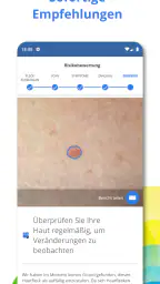 SkinVision screenshot