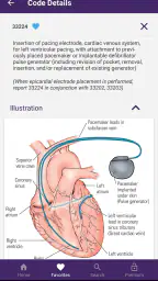 CPT® QuickRef screenshot
