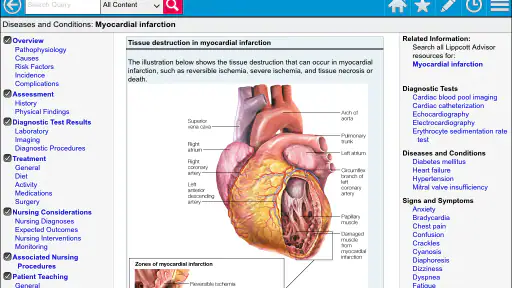 Lippincott Nursing Advisor screenshot