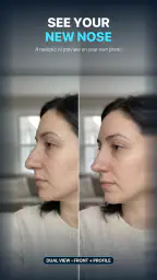 Nose Job - Plastic Surgery AI screenshot