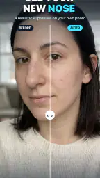 Nose Job - Plastic Surgery AI screenshot