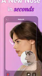 Nose Job Simulator AI: Nosefix screenshot
