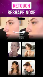 Nose Job Simulator AI: Nosefix screenshot