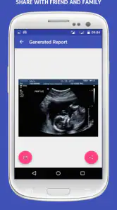 UltraSound Spoof screenshot