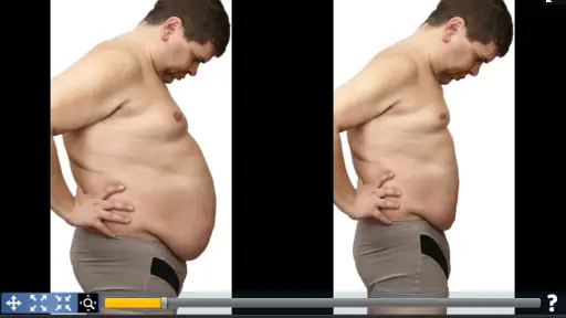 Plastic Surgery Simulator screenshot