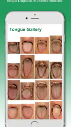 Shen-Acupuncture screenshot