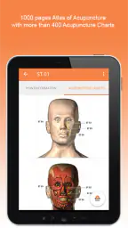 Shen-Acupuncture screenshot