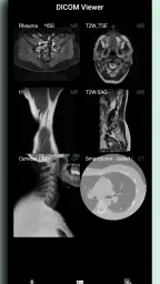 DICOM Viewer screenshot