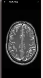 DICOM Viewer screenshot