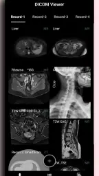DICOM Viewer screenshot