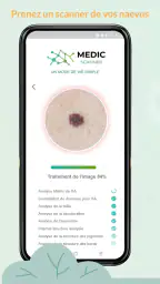 Medic Scanner - analyse peau screenshot
