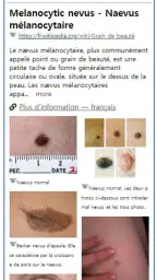 Model Derm – Maladie de peau screenshot