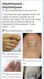 Model Derm – Maladie de peau screenshot