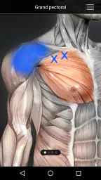 Muscle trigger point anatomie screenshot