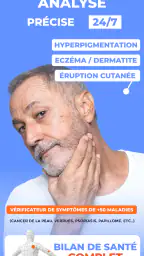 Scanner santé peau: Skinive AI screenshot